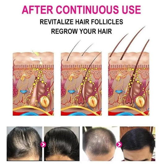 Nourishing Anti- Greying Hair Serum for All Hair Types – 30ml