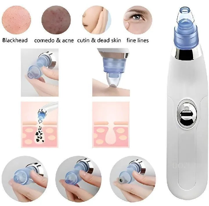 Dead Skin Remover Black Head Remover