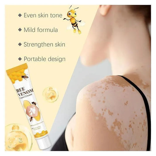 Bee Venom Vitigo Cream