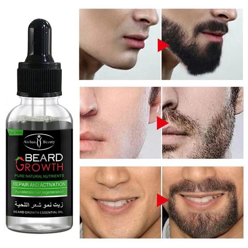30ml Premium Beard Oil for Hair Growth & Anti-Dandruff - 1 Pcs