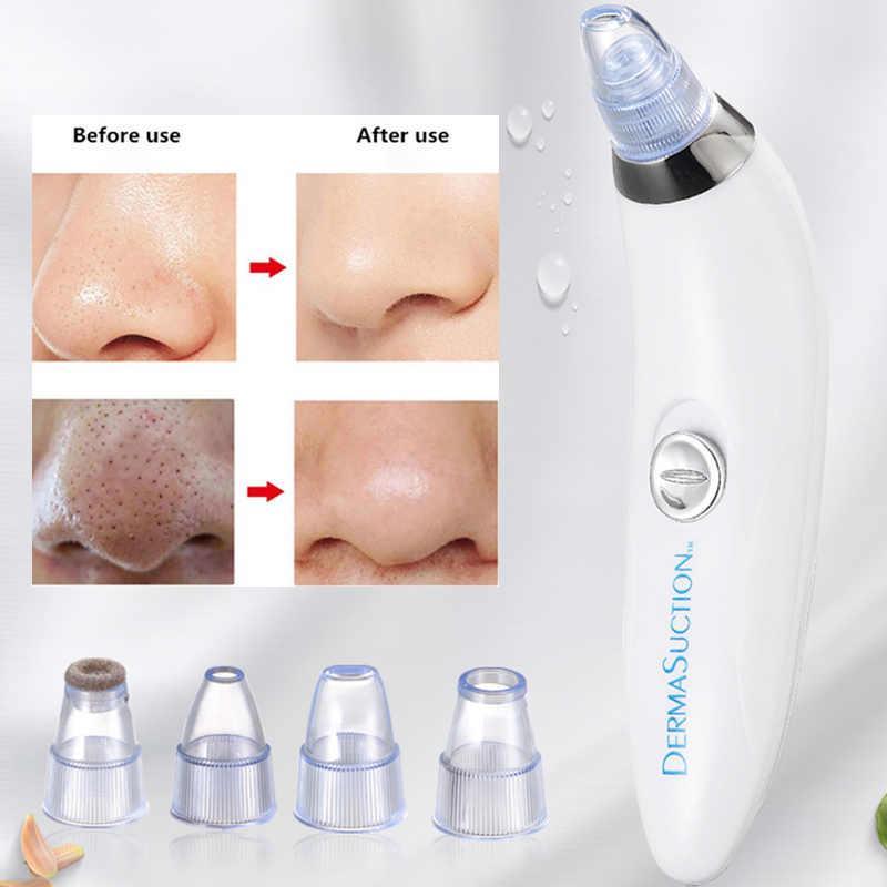 💖 Electric Blackhead Pore Vacuum – 4-in-1 Facial Cleanser & Dirt Remover 🌸