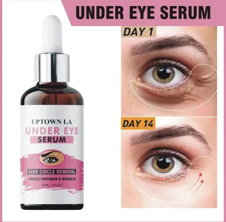 Uptown La Dark Spots Removal Eye Serum