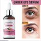 Uptown La Dark Spots Removal Eye Serum