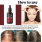 Anti-Hair Loss Hair Serum