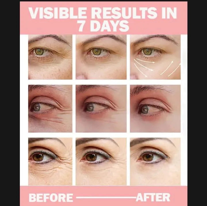 Uptown La Anti Dark Circle Eye Cream