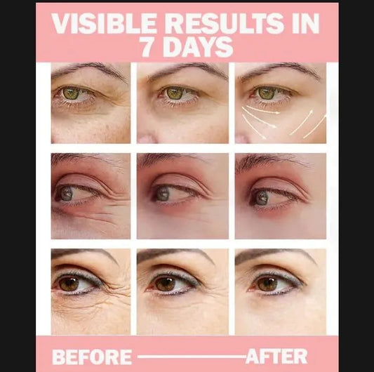 Uptown La Anti Dark Circle Eye Cream