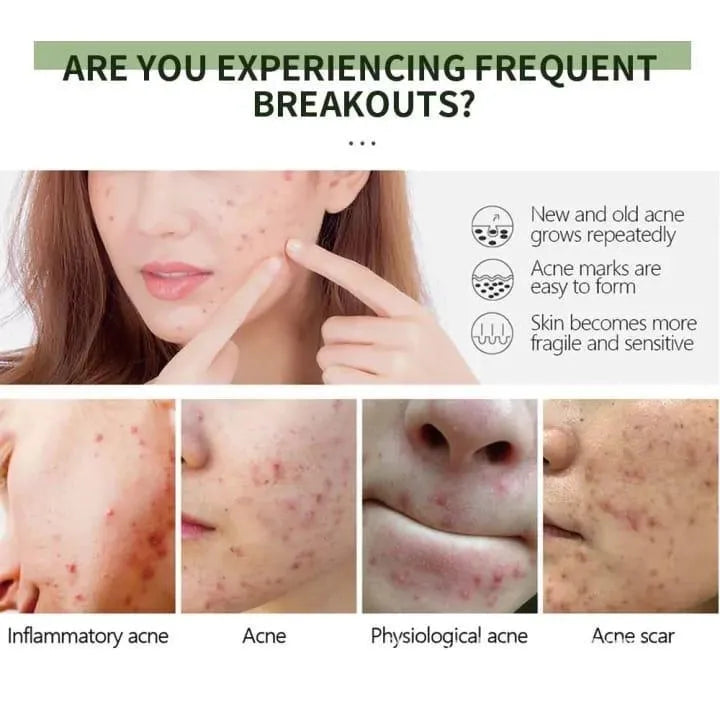 Uptown La Acne Scar Removal Exfoliating Gel